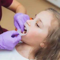 Dziecko u dentysty, przygotowanie do lakowania zębów. Sprawdź, jaka jest lakowanie zębów cena.