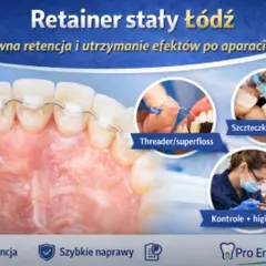 Retainer stały to pewna retencja zębów po leczeniu ortodontycznym. Pokazano higienę z jego użyciem.
