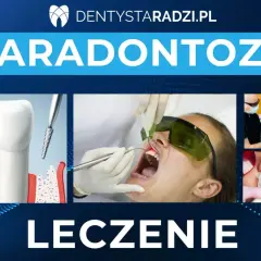 Ilustracje pokazują leczenie paradontozy: przekrój zęba z ubytkami, zabieg laserowy i stomatologiczne szynowanie zębów.