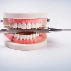 Model szczęki z narzędziem dentystycznym. Zastanawiasz się nad karierą? Sprawdź, jakie są technik dentystyczny zarobki.