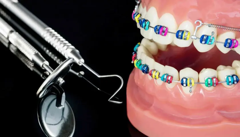 Kolorowy aparat na zgryz krzyżowy na modelach zębów, obok narzędzi dentystycznych.