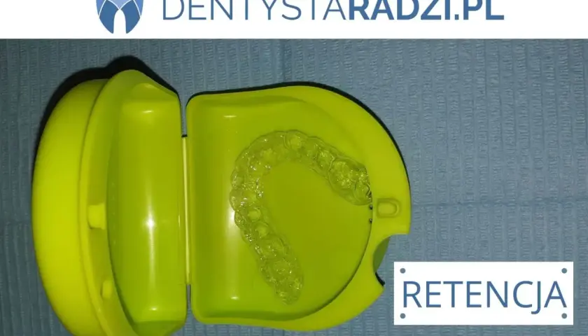 Przezroczyste nakładki na zęby po aparacie ortodontycznym w zielonym etui. Retencja to klucz do pięknego uśmiechu.