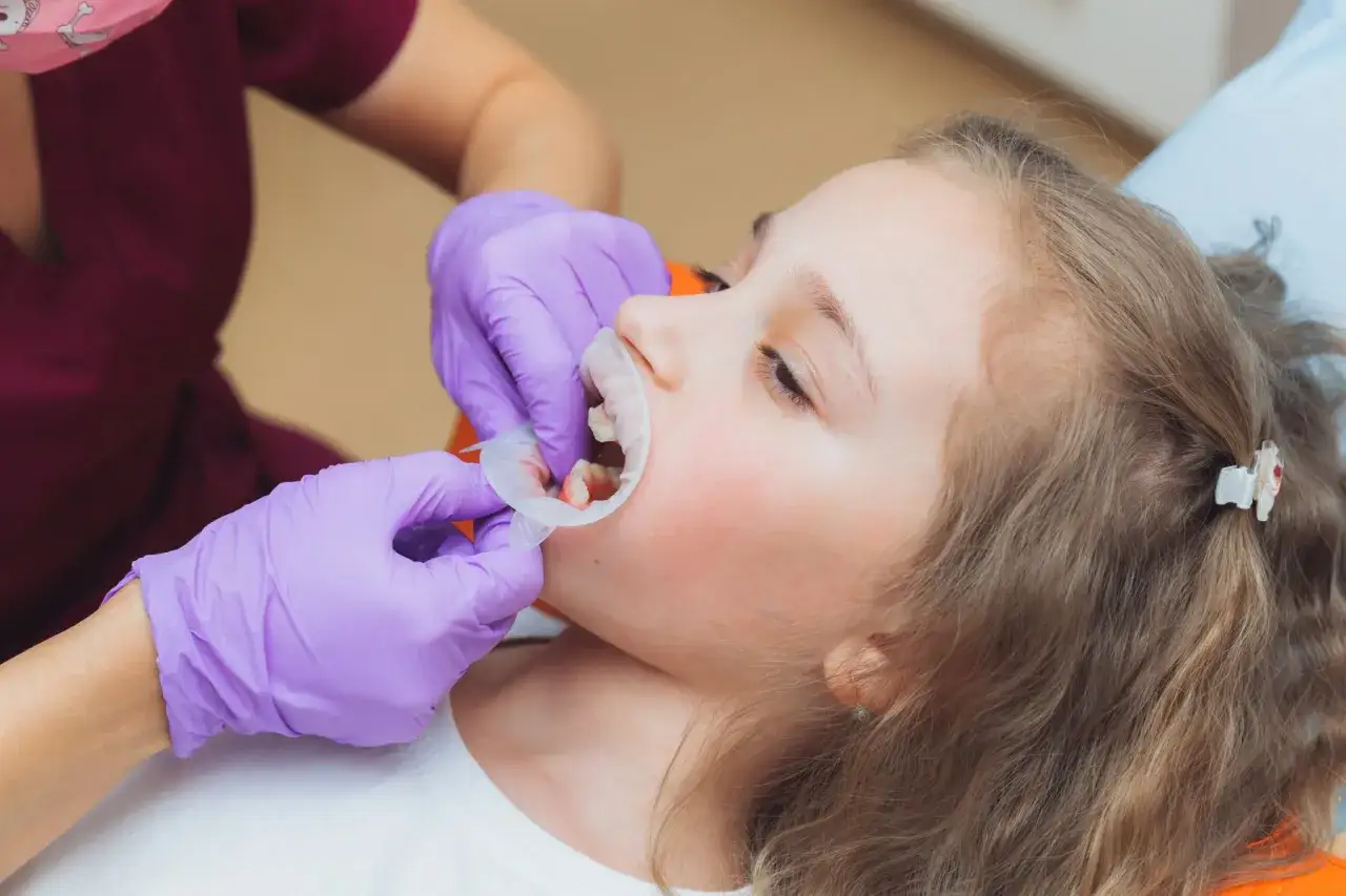 Dziecko u dentysty, przygotowanie do lakowania zębów. Sprawdź, jaka jest lakowanie zębów cena i zadbaj o uśmiech malucha.