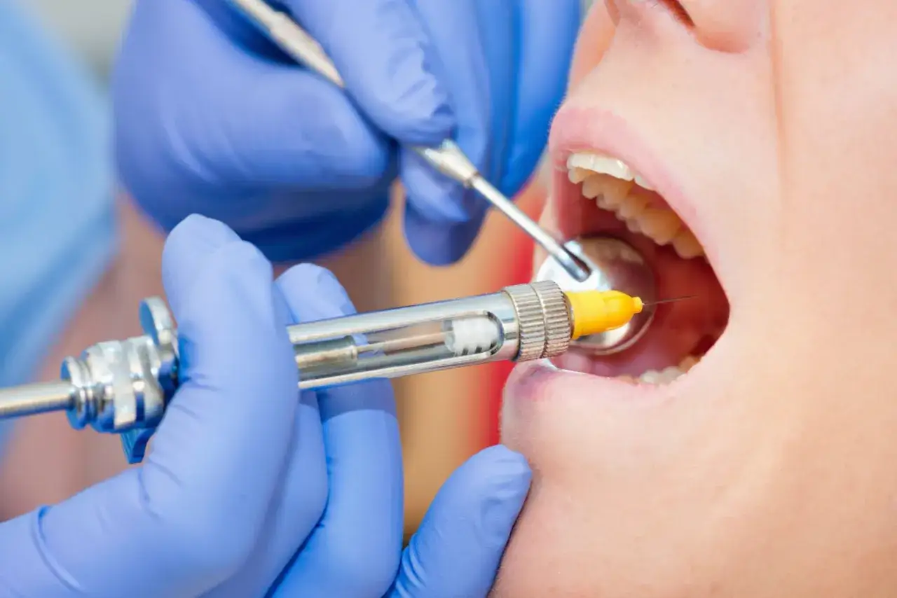 Dentysta wykonuje znieczulenie przewodowe, podając środek znieczulający do jamy ustnej pacjenta.