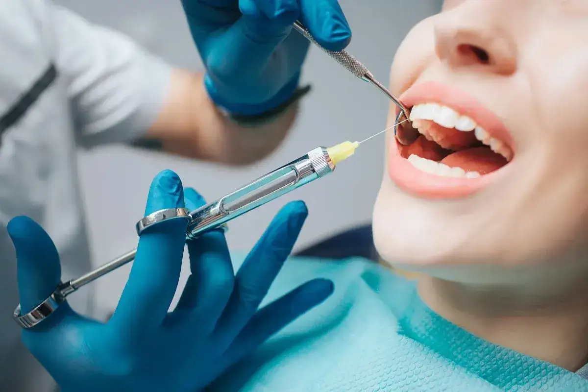 Dentysta podaje znieczulenie, prawdopodobnie bupiwakainę, do jamy ustnej pacjenta.